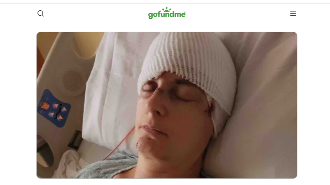 A Texas woman was mauled by four dogs in her fenced-in yard, her family says.