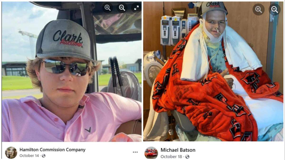 Braycin Parrish is recovery after being electrocuted and burned in a farming accident in Texas, family says.