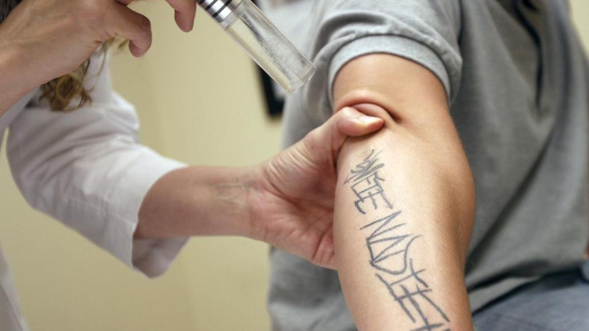In this file photo from 2011, a nurse at the Skin Center in Pittsburgh uses a laser in the first treatment to remove a tattoo from Christopher Guajardo, 24, to help him in his goal to enlist in the United States Marine Corps.