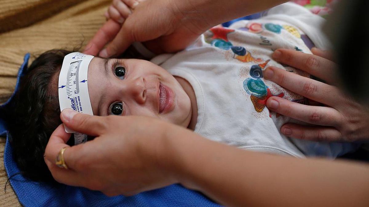 Three-month-old Esther Kamilly has her head measured by Brazilian and U.S. health workers from the Centers for Disease Control and Prevention at her home in Joao Pessoa, Brazil, as part of a study on the Zika virus and microcephaly.