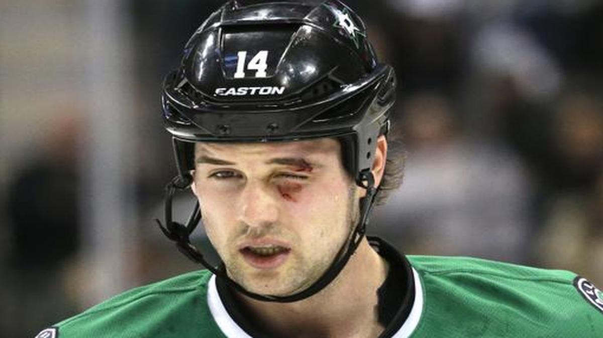 
Dallas Stars left wing Jamie Benn skates off the ice after he was hit with a stick during the first period of an NHL hockey game against the Tampa Bay Lightning on Thursday, Feb. 5, 2015, in Dallas. 
